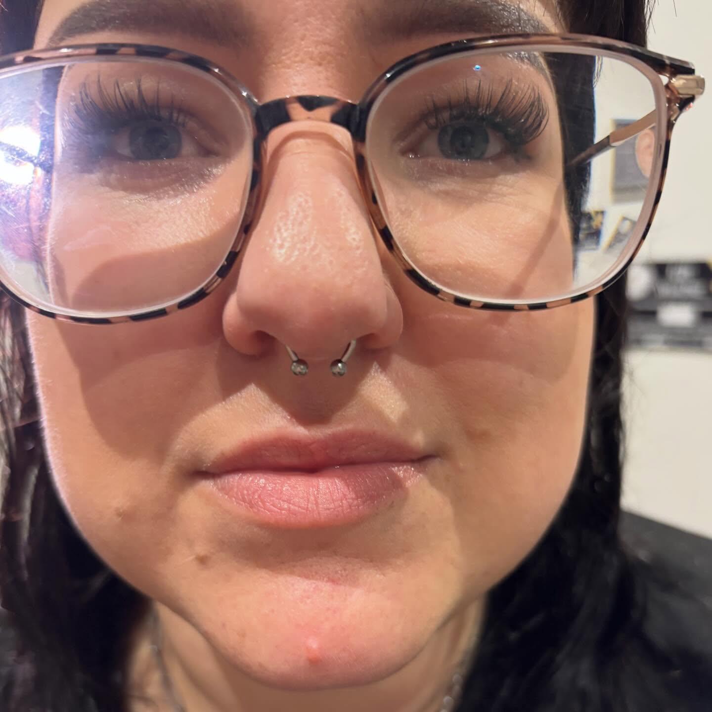 Septum 2