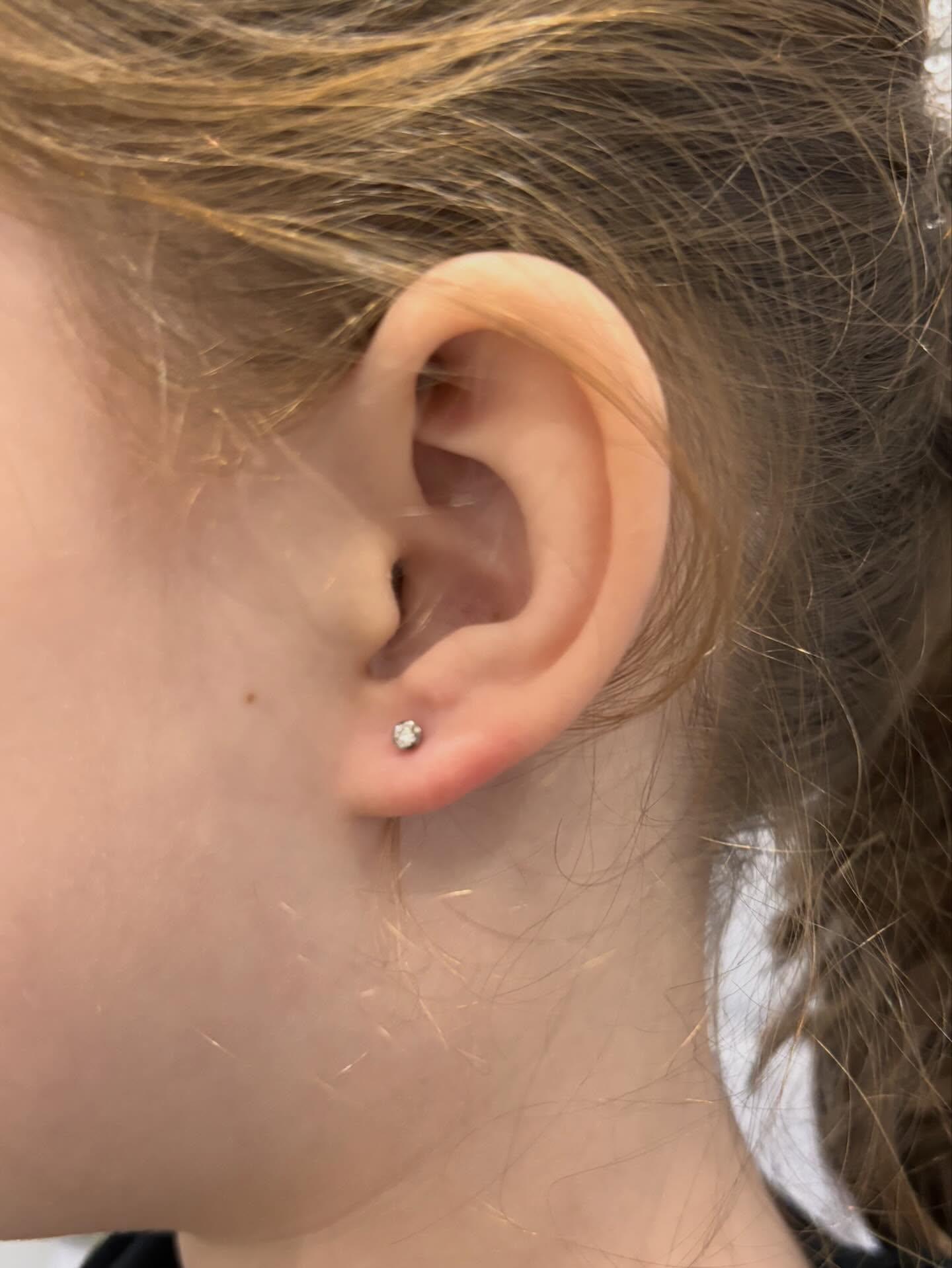 Lobes
