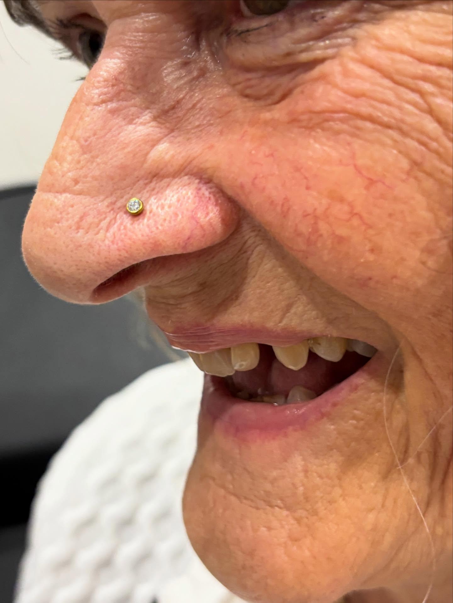 Photos for Website/Nostril 3