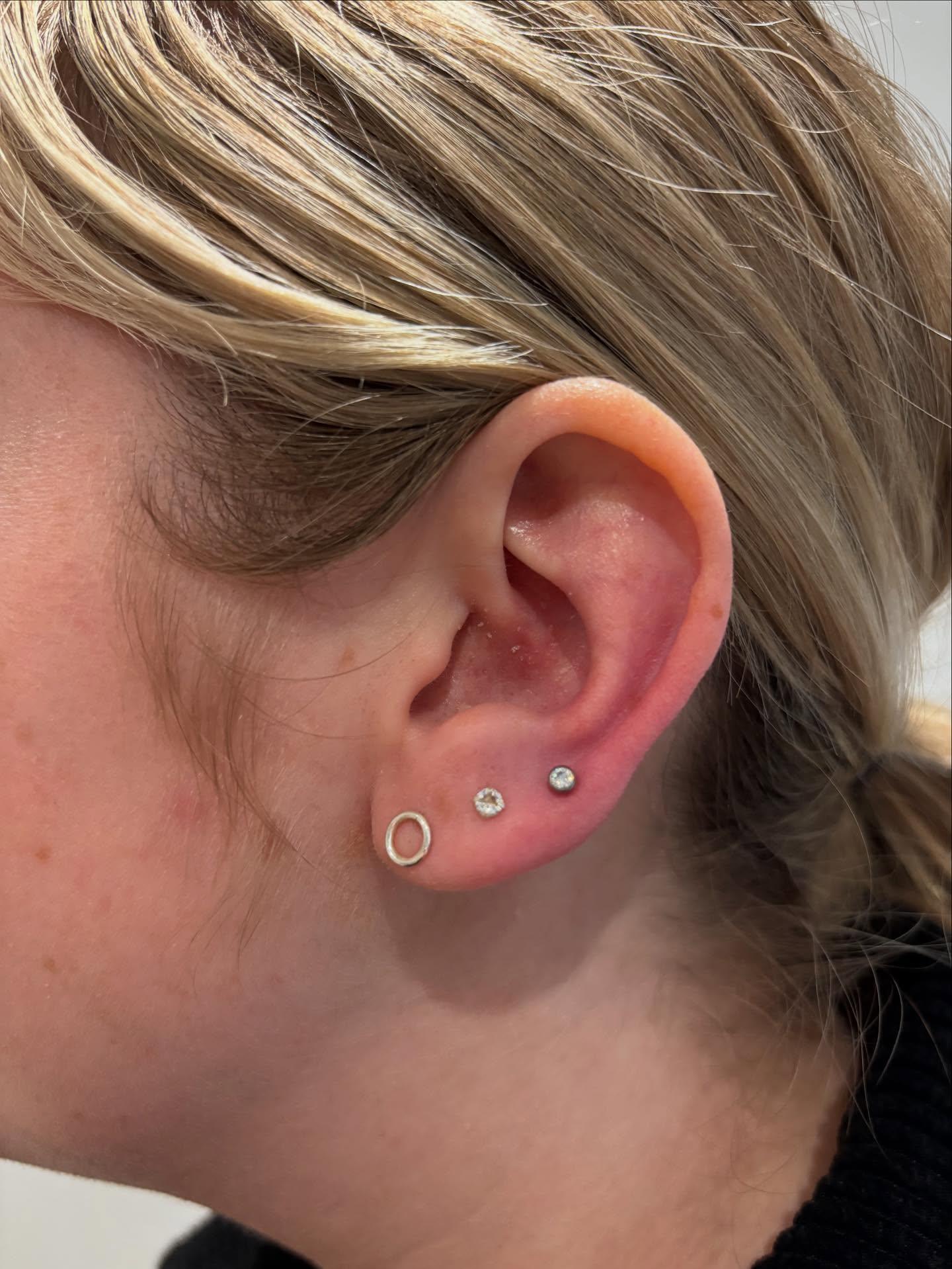 Third Lobes
