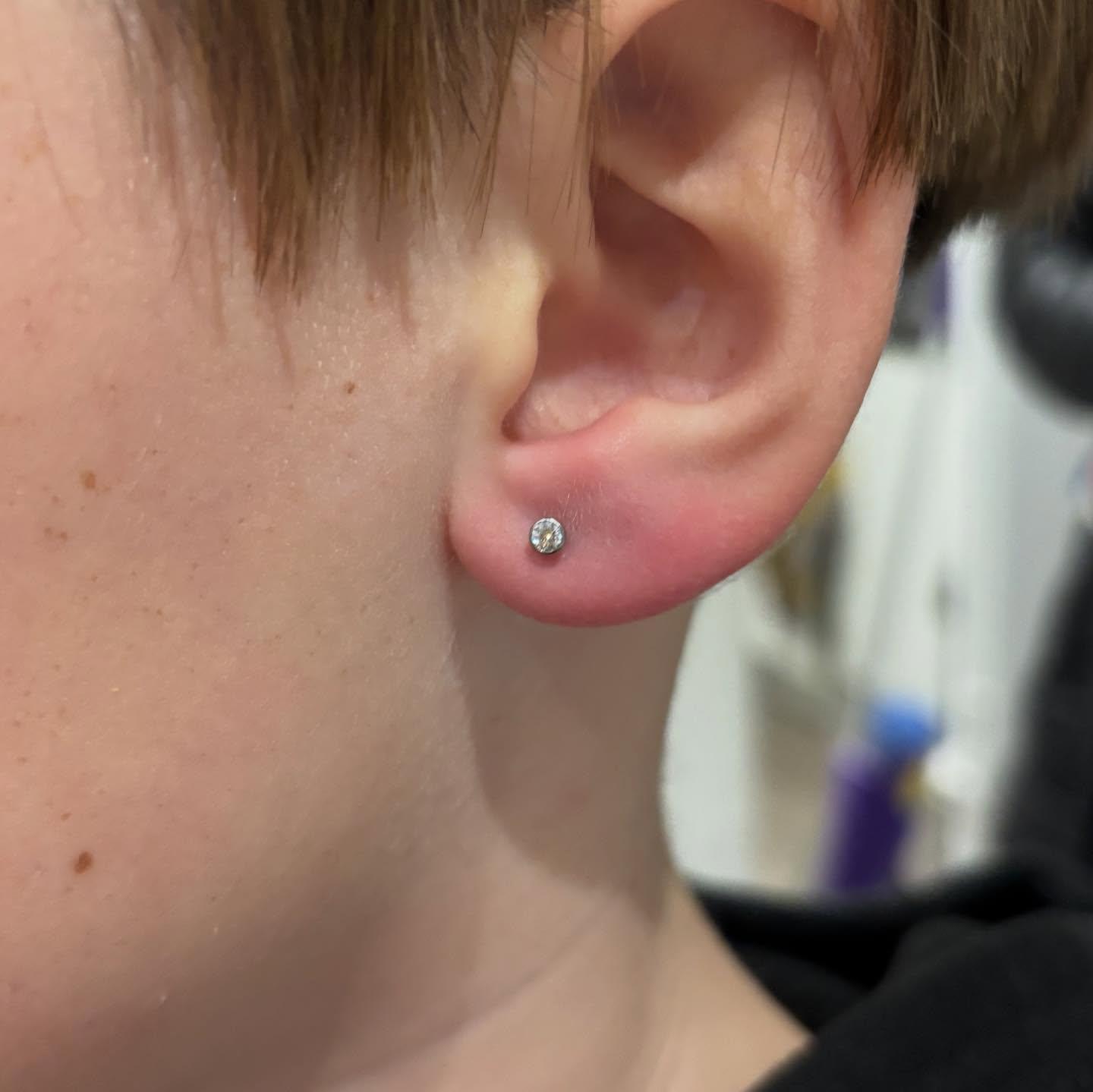 Lobes4