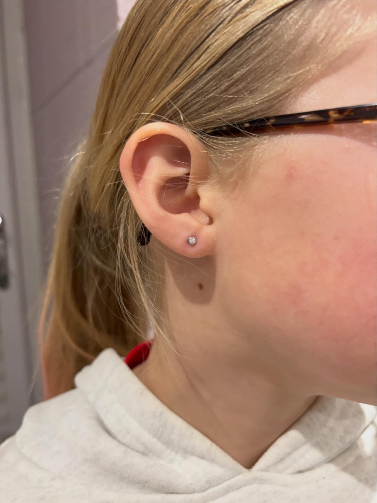 Lobes2