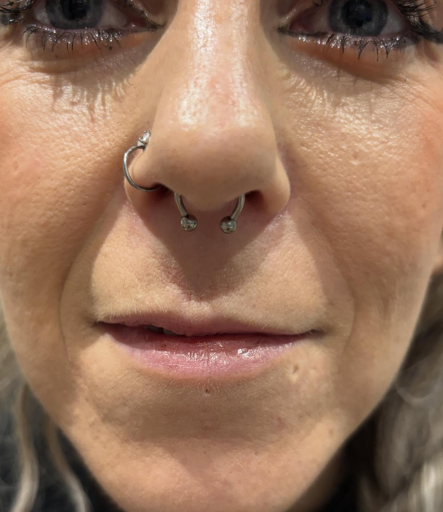 Septum
